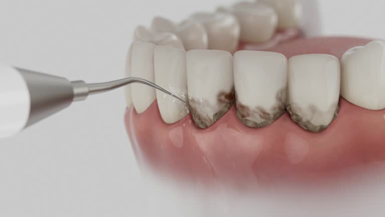 Trusted Dental Crowns And Bridges service in Crow Agency, MT - Dentist Open Now